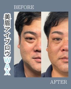 7CC94A09 3AC3 4F9E 8852 3216BB08B351 夏こそ眉毛を整え垢抜け|沖縄メンズ脱毛