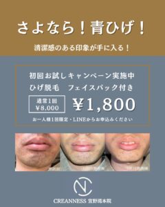 CBCA389C 6FCC 437C A515 D5341D37076B 初回限定・お試しひげ脱毛キャンペーン|沖縄メンズ脱毛