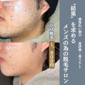 DDB78759 9AEA 49C1 BC1E 5AD9AF75028B 初めてご来店される方へ|沖縄メンズ脱毛