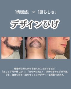 DF4ACC58 302B 4E71 BD0E 39E965059235 大人気！デザインひげ|沖縄メンズ脱毛