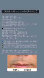 脱毛したのになんか物足りない…そんな方へ|沖縄メンズ脱毛 1 264A2DEB C47B 401C A2A7 5132B7A25AA1 脱毛したのになんか物足りない…そんな方へ|沖縄メンズ脱毛