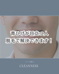 DD61D2C2 109E 4E4E 96FF 5F5260B58451 その青ひげ脱毛で解決できます！沖縄メンズ脱毛