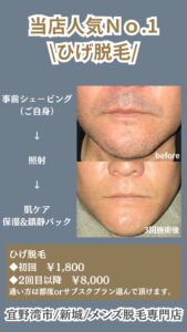 ABB7DBD9 43D0 48B3 80AD 630693A5C0ED ひげ脱毛を試してみたい方必見！沖縄メンズ脱毛専門店