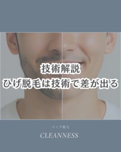 339691CE 940D 46B3 A03B 71430B67B9D3 ひげ脱毛同じ機械でも技術で効果3倍！沖縄メンズ脱毛