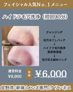 毛穴の汚れさようなら!沖縄メンズ脱毛 1 CD7E6A45 FD3A 4E9C 9FC4 DE02504D1CF8 毛穴の汚れさようなら!沖縄メンズ脱毛