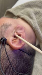 FCEA5CEC DCE8 4A76 9291 86FEB3FE1B53 耳の毛もしっかり脱毛！沖縄メンズ脱毛専門店