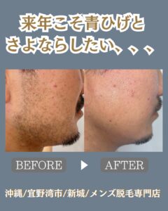 メンズ脱毛サロンをお探しの方へ|沖縄メンズ脱毛 1 16A3FE67 F190 4937 A057 BF4FBB0F326D メンズ脱毛サロンをお探しの方へ|沖縄メンズ脱毛