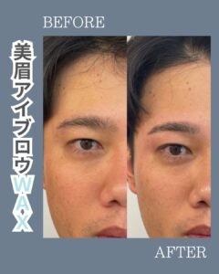 隠れ人気メニュー!眉毛ワックス脱毛!沖縄メンズ脱毛 1 38373422 2FE8 46C2 9F96 7590E7EBB7E5 隠れ人気メニュー!眉毛ワックス脱毛!沖縄メンズ脱毛