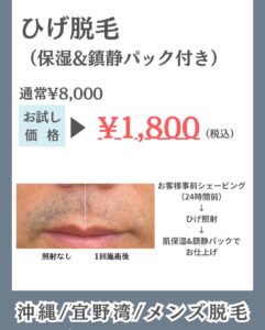 1B204087 7FC2 453C A53C 3ED7AD9B3963 大好評の半額キャンペーン残り9日です✨沖縄メンズ脱毛