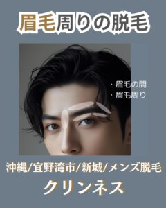 人気オプションメニューの眉毛周り脱毛|沖縄メンズ脱毛 1 458792B7 3E6F 4D71 89BD F3E661A848BF 人気オプションメニューの眉毛周り脱毛|沖縄メンズ脱毛
