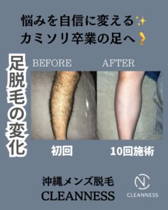 悩みを自信に変える!沖縄メンズ脱毛 1 A997369E 3D21 4E52 9018 F7A0E934F434 悩みを自信に変える!沖縄メンズ脱毛