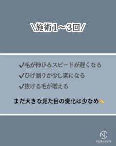脱毛って何回で減るの?沖縄メンズ脱毛 2 C344BBF8 092E 4CC0 B0A2 5899A27CBB46 脱毛って何回で減るの?沖縄メンズ脱毛