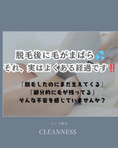 脱毛後に毛がまばら?沖縄メンズ脱毛 1 AA155510 6354 49CF B619 83E16F029EEF 脱毛後に毛がまばら?沖縄メンズ脱毛