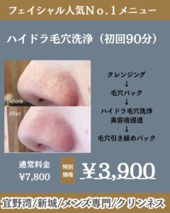 夏におすすめ毛穴洗浄!沖縄メンズ脱毛 6 97B753D6 5C6E 4B42 86D7 D03A3B569591 夏におすすめ毛穴洗浄!沖縄メンズ脱毛