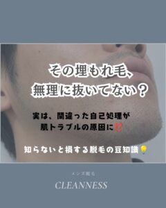 0E42E591 2DCC 4C50 9DF5 64DD28E5659E 知らないと損する脱毛の豆知識！沖縄メンズ脱毛